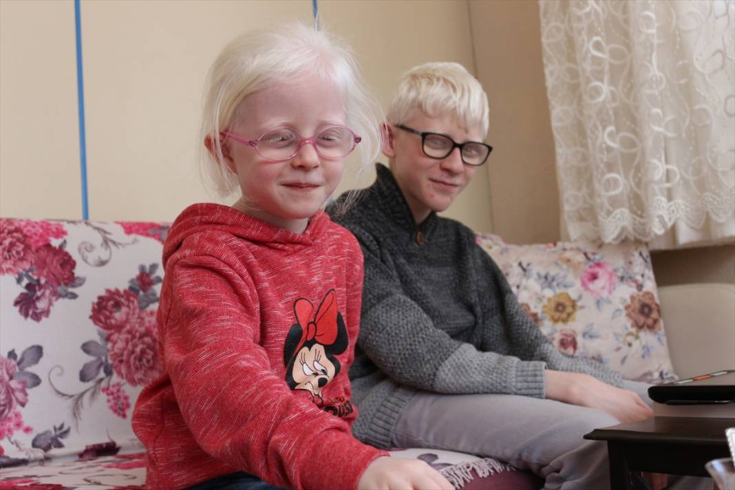 Yüzde 90 görme engelli, aynı zamanda albinizm hastası! Konyalı Hüseyin Ali tüm engellere başarılarıyla meydan okuyor 10