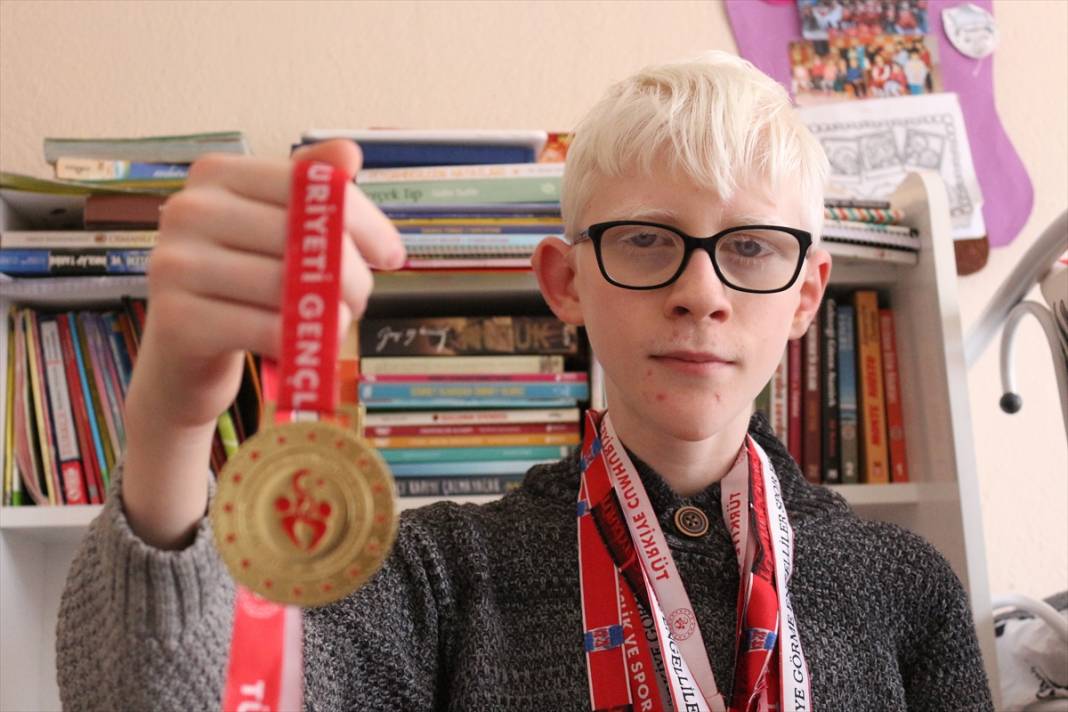 Yüzde 90 görme engelli, aynı zamanda albinizm hastası! Konyalı Hüseyin Ali tüm engellere başarılarıyla meydan okuyor 3