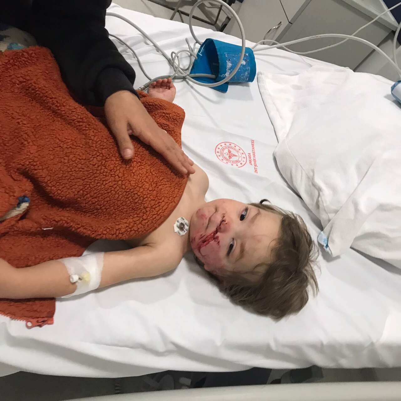 Pazar dönüşü 2 kardeşe pitbull dehşeti! Yüzlerini bakılmayacak hale getirdi 2