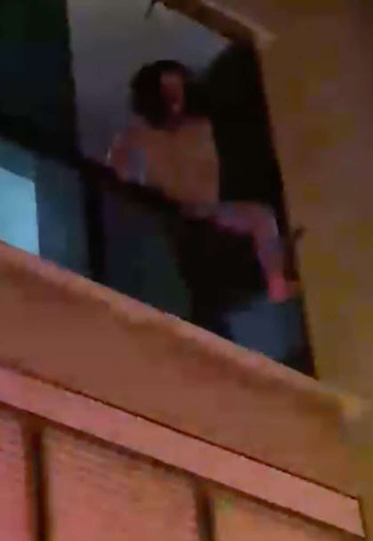 Eşi burnunu ısırıp koparmıştı! Genç kadın o gece yaşananları anlattı 2