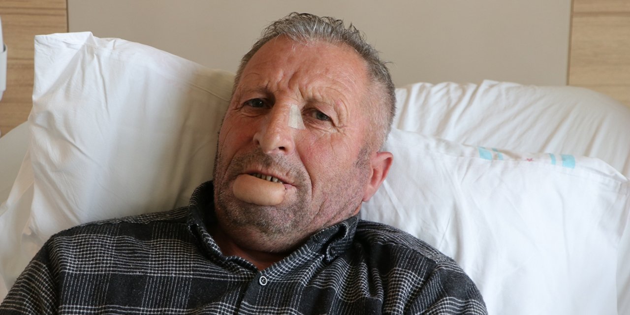 Dudaklarını kaybetmek üzere olan hastayı doktorlar böyle kurtardı