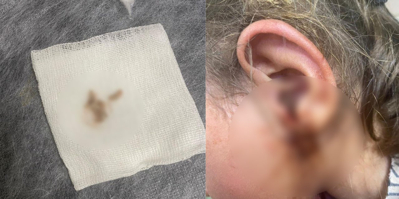 Doktora giden 3 yaşındaki çocuğun kulağından çıkanlar dehşete düşürdü