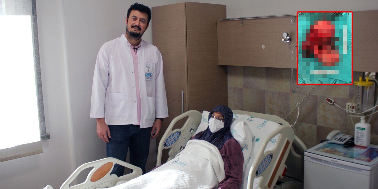 Yer Konya! Karın ağrısıyla gitti, çıkan kitle doktorları bile şaşırttı