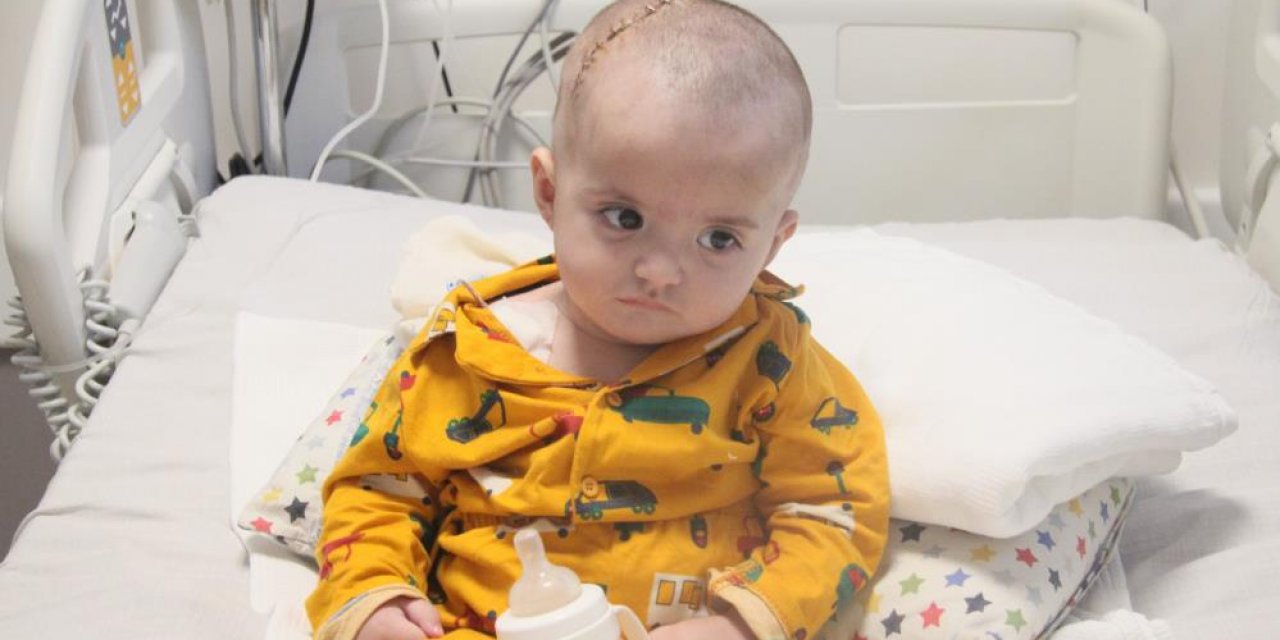 Enfeksiyon geçirdiği sanılan 9 aylık bebek beyin kanamasından kurtarıldı