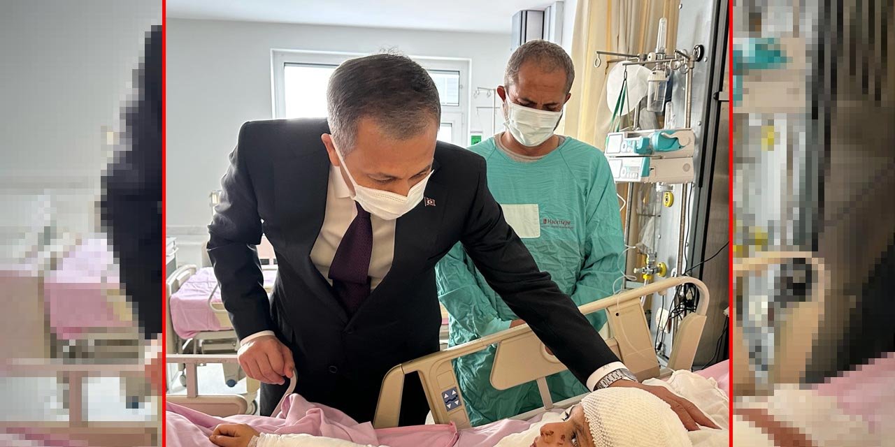 Bakan Yerlikaya başıboş köpeklerin saldırısına uğrayan çocuğu ziyaret etti