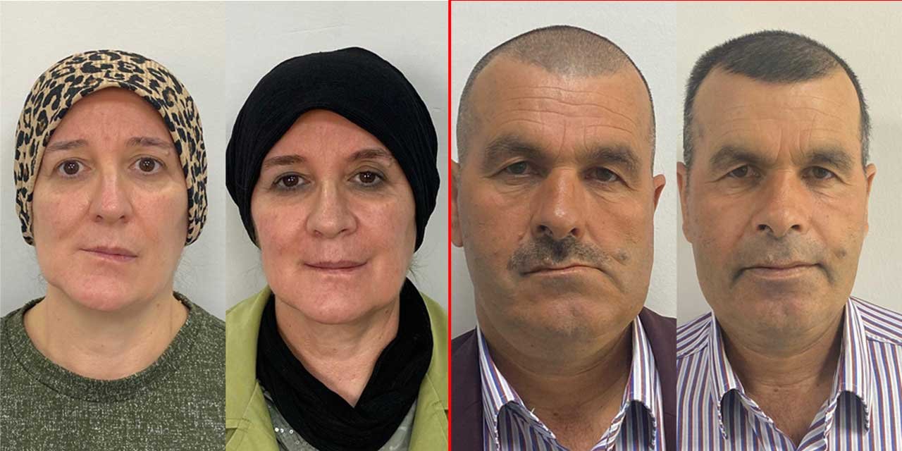 Yüz asimetriği bozulan iki hasta Konya’da şifa buldu