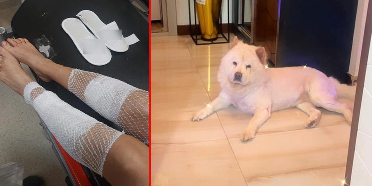 Kıskanç köpek sahibinin bacağını parçaladı