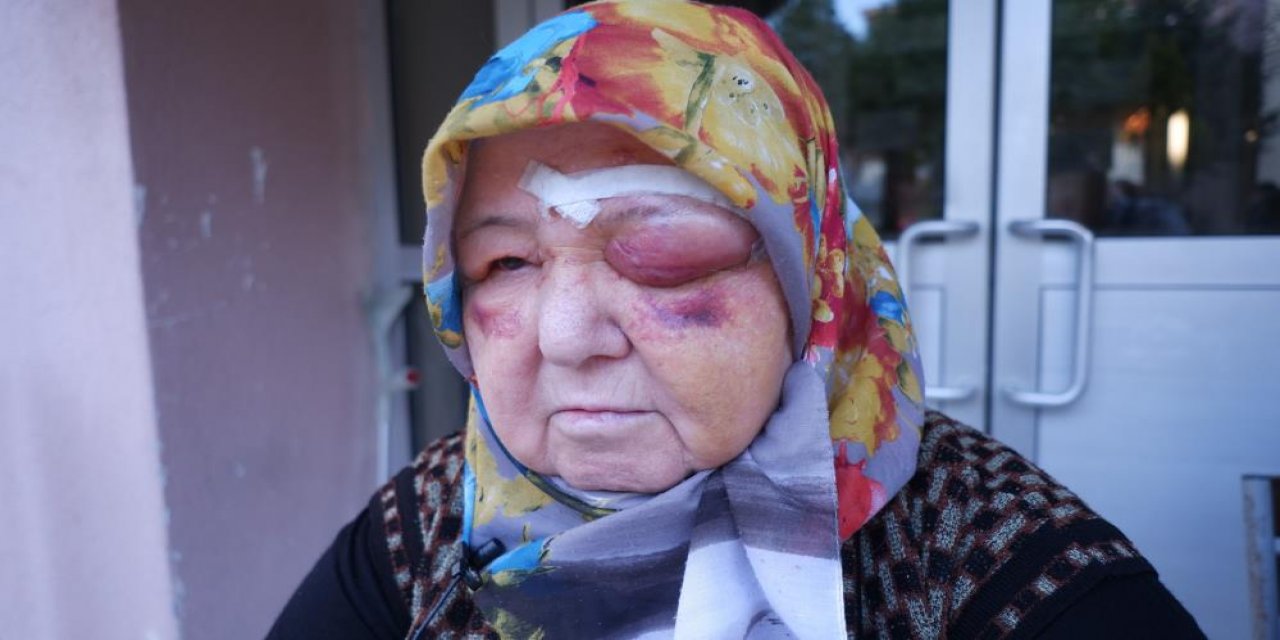 Sokak köpeklerinin saldırdığı yaşlı kadın yaralandı