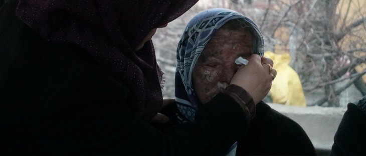 Konya'daki yangında engelli kızını kaybeden annenin büyük acısı