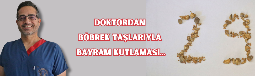 Doktordan böbrek taşlarıyla bayram kutlaması...