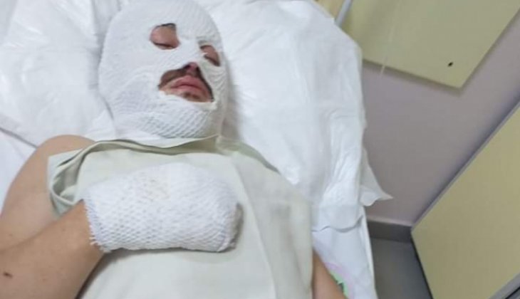 Konya’da klima gazı patladı: 1 yaralı