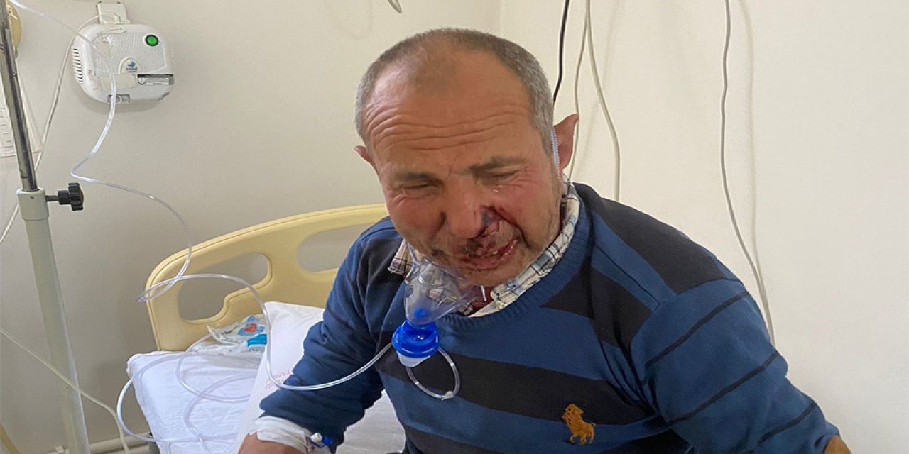 Alkol almayan engelli adamı öldüresiye dövdüler