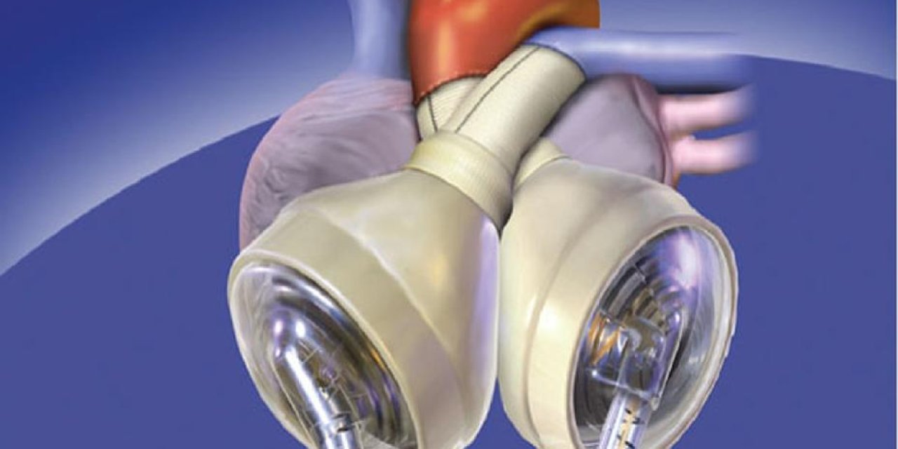 Tıp tarihinde devrim! Yapay kalple 100 gün yaşadı