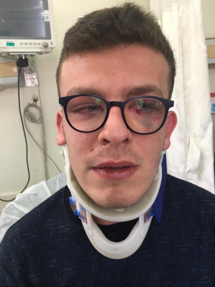 Otizmli genç Erdem'in annesi, oğlunu darbeden zanlının adliyeye sevkini memnuniyetle karşıladı