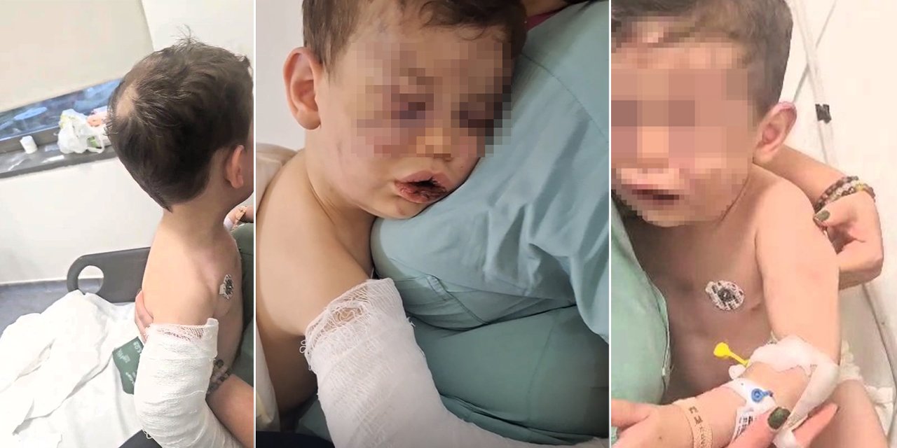 Türkiye'yi sarsan vahşet! Annesinin sevgilisi tarafından öldüresiye dövüldü