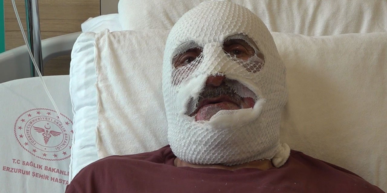 Gaz kaçağını çakmakla kontrol etti: Hem kendini hem evini yaktı