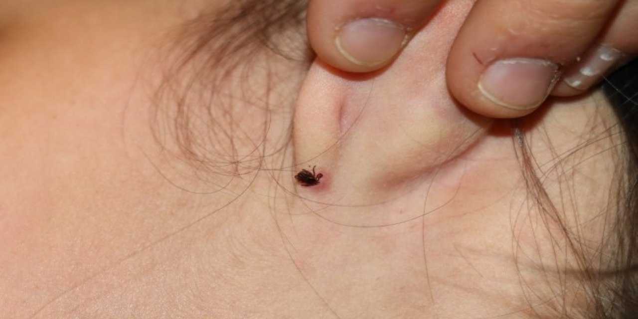 Havalar ısındı, kene tehdidi kapıda