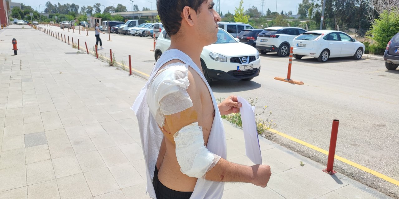 Hastane yolunda köpek saldırısı! Kırık koluyla mücadele edemedi