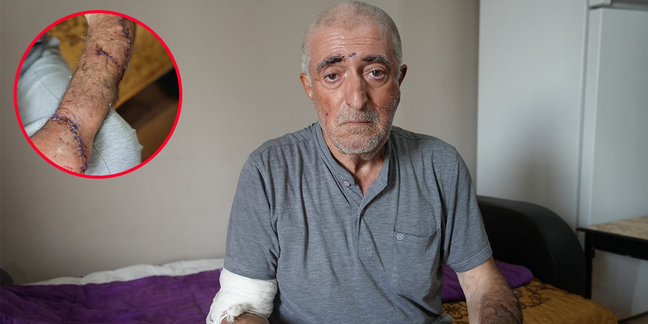 Eşinin barışma teklifine inandı! Uykusunda defalarca bıçaklandı