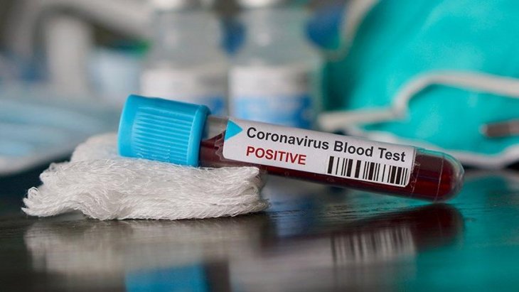 Sağlık Bakanlığı ve poliste ‘Koronavirüs hırsızlığı’ alarmı!