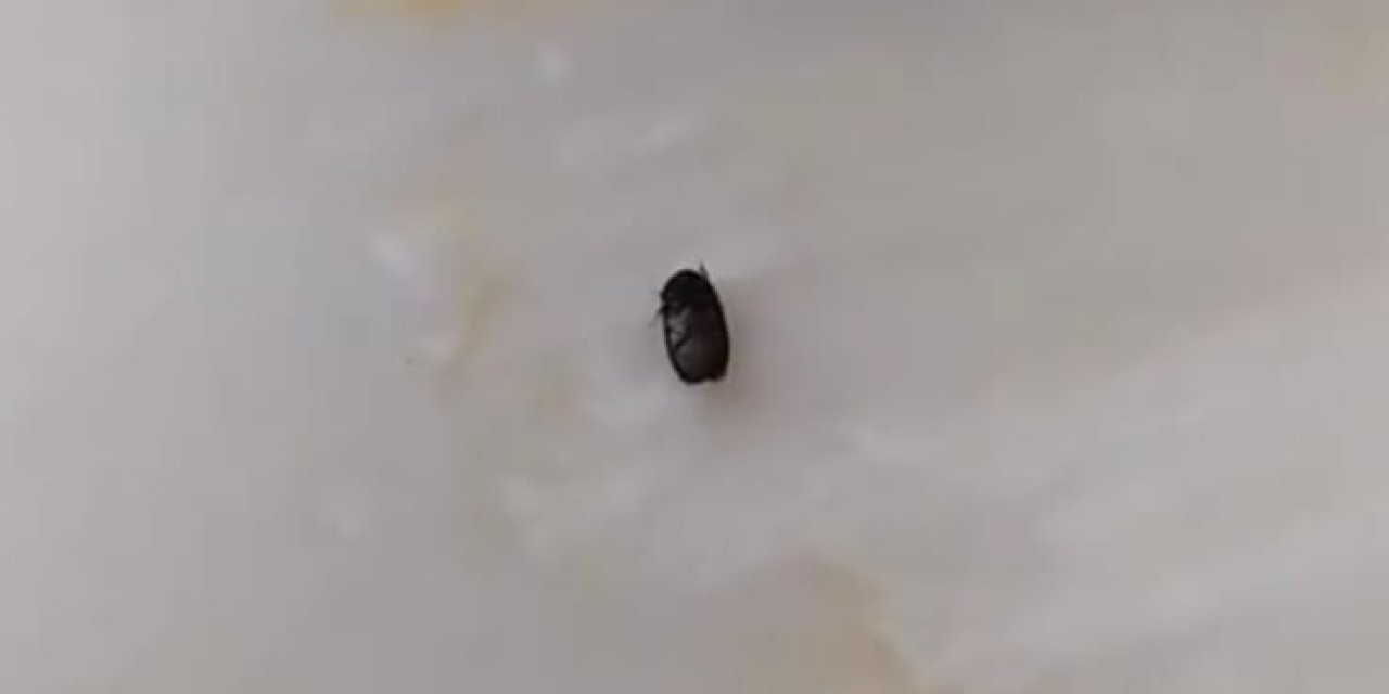 Parkta oynayan çocuğun kulağına kene yapıştı