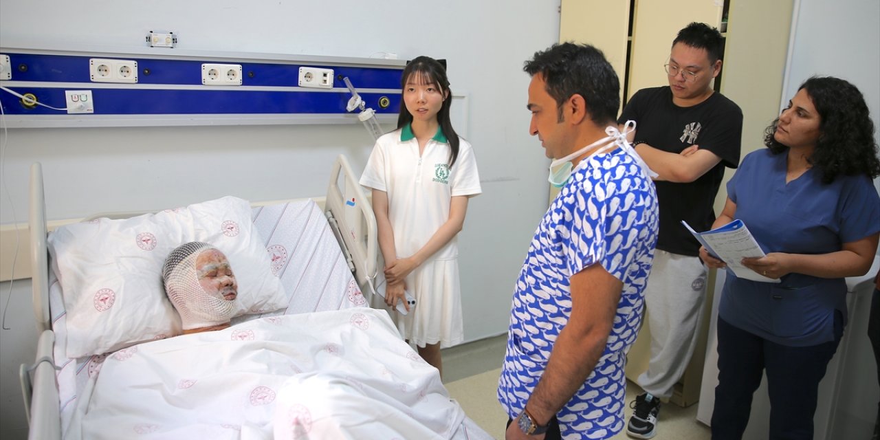 Çakmak fabrikasında diri diri yandı! Çinli işçi mucizeyi yaşıyor