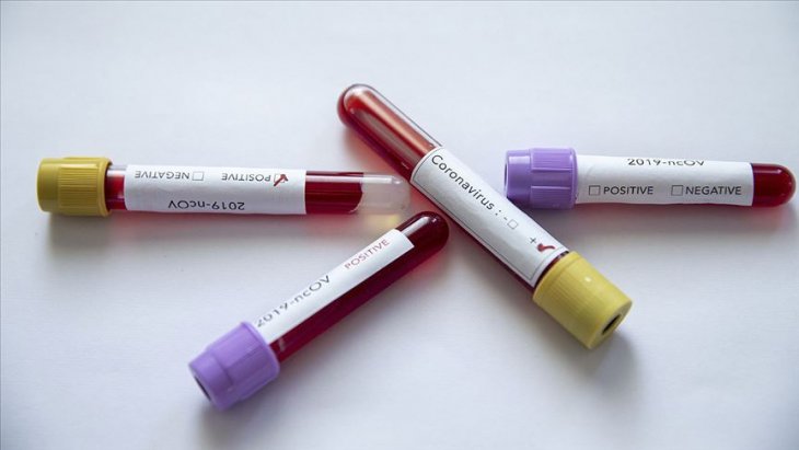 Dünyada 25 milyon kişi Kovid-19 nedeniyle işini kaybedebilir