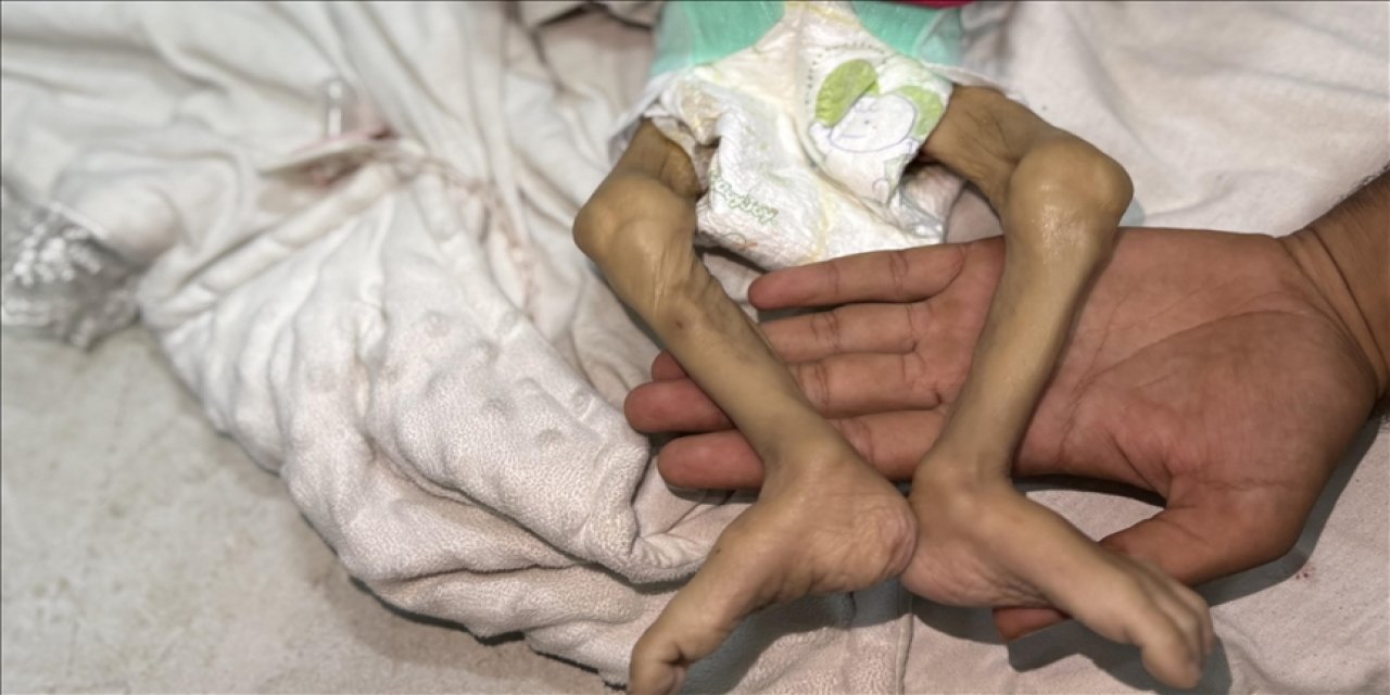 Gazze Şeridi'nde son 24 saatte 1'i çocuk 14 Filistinli açlıktan hayatını kaybetti