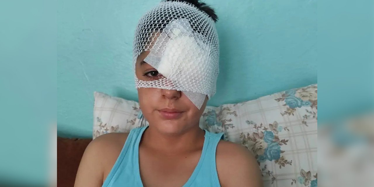 Köpek saldırısından kaçan çocuğa otomobil çarptı