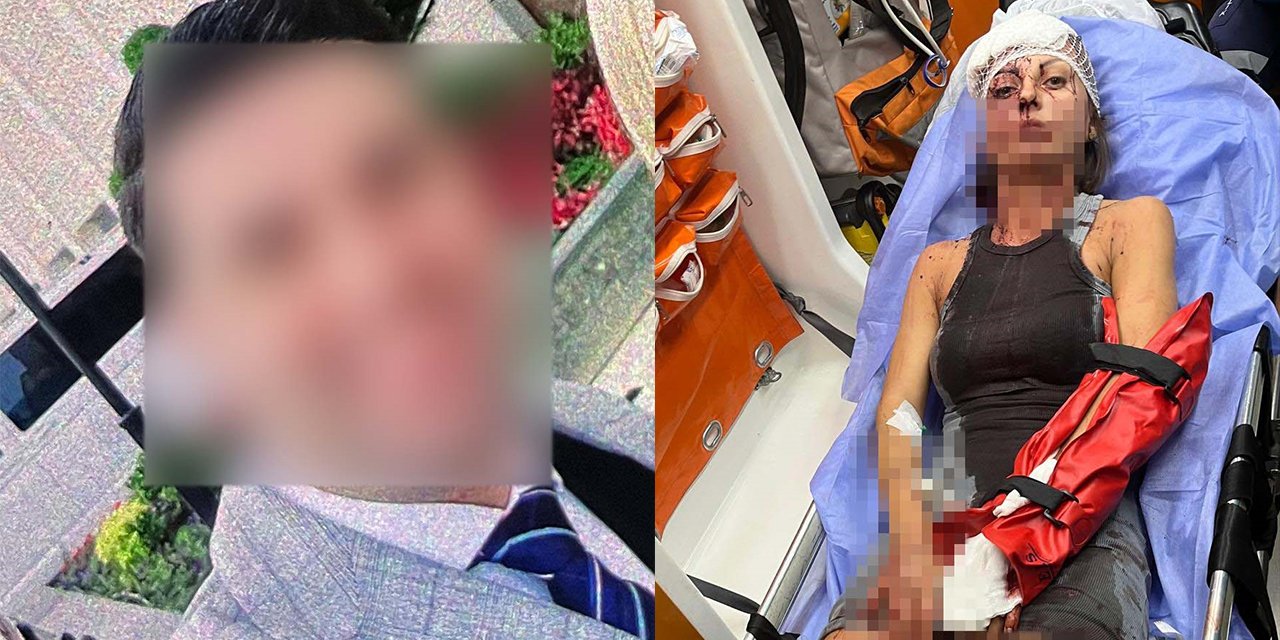 Karısına pusu kurdu, kırmadık kemiğini bırakmadı