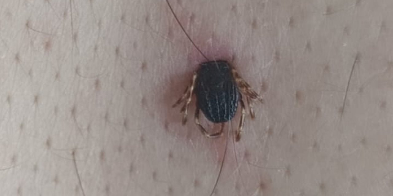 Konya'da sıcaktan kaçmak için bağ evine kaçtı, kene dehşeti yaşattı