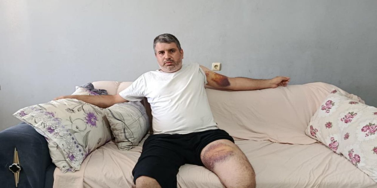 Miras paylaşımında beyzbol sopalı hesaplaşma