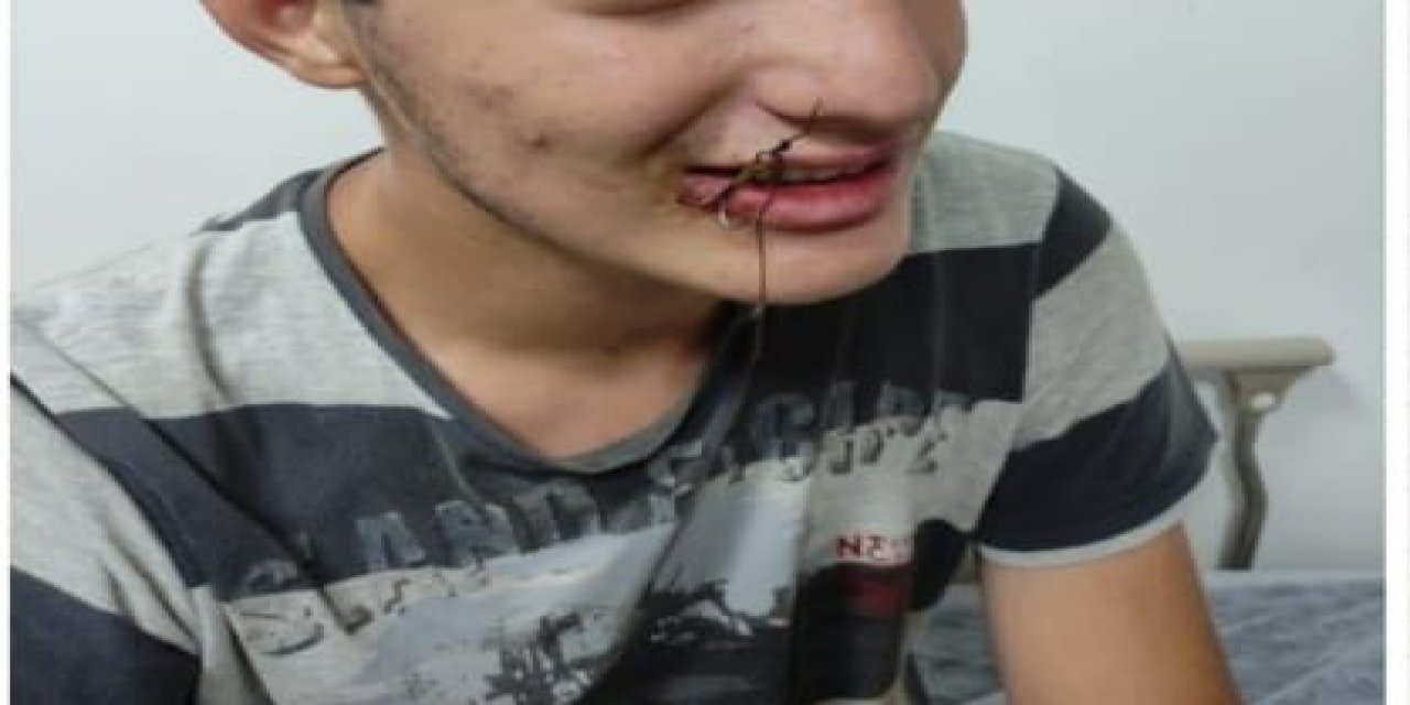 7 yaşındaki çocuk balık oltasına takıldı