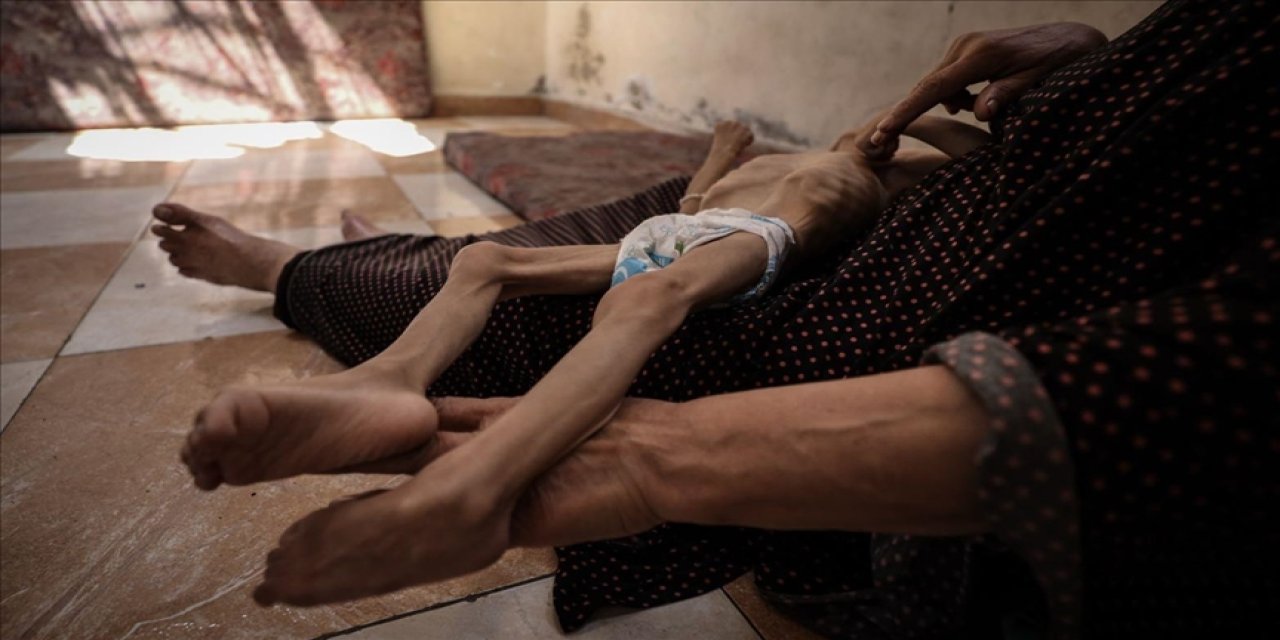 Gazze'de son 24 saatte 2'si çocuk 5 kişi daha açlıktan hayatını kaybetti