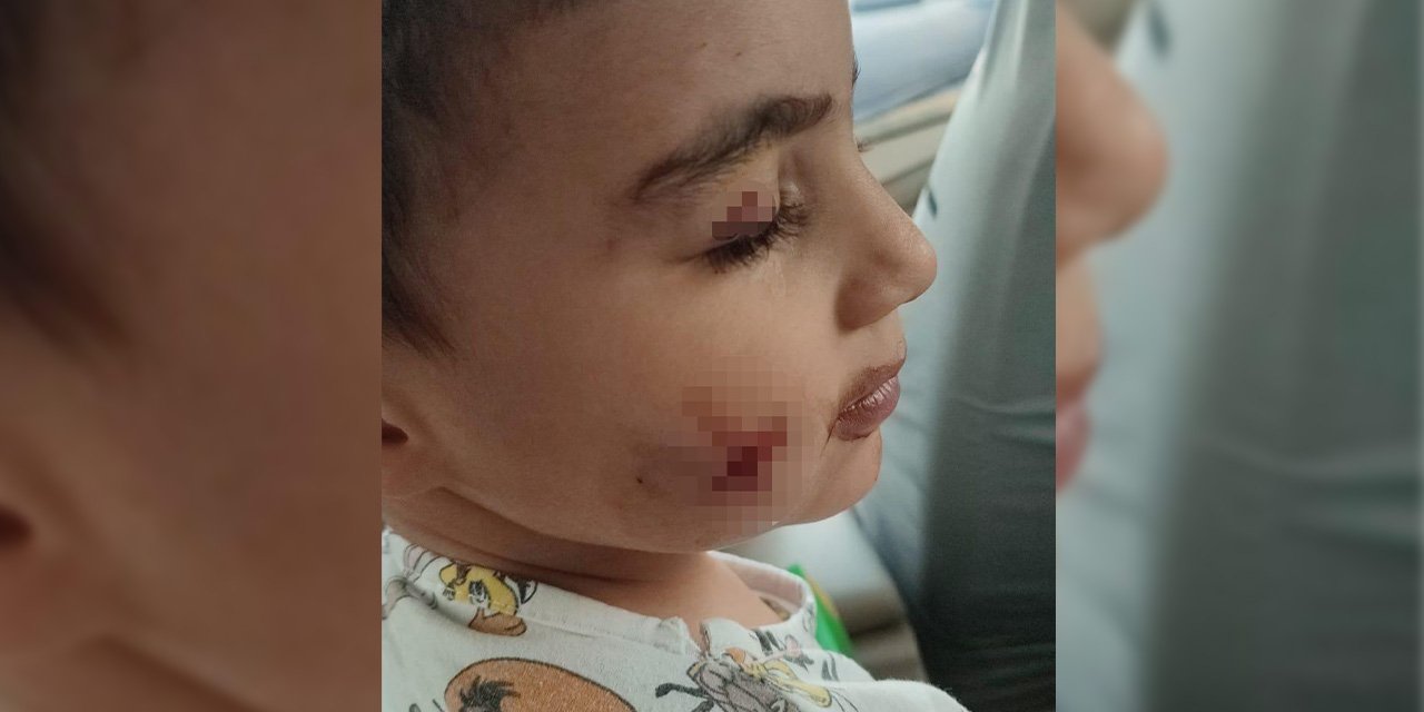 Uyuyan çocuğa lağım faresi saldırdı