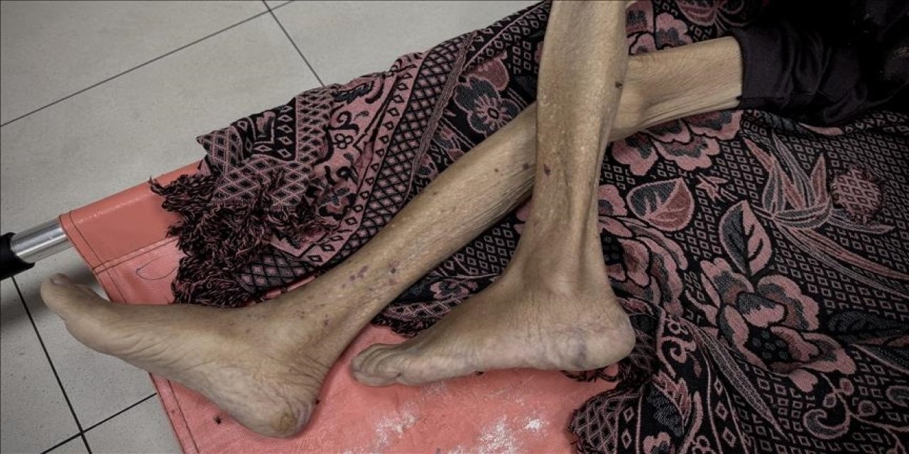 Gazze'de 3'ü çocuk 10 kişi daha açlıktan hayatını kaybetti