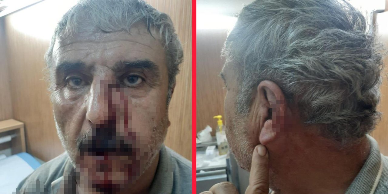 Doktor, sokak ortasında emekli öğretmenin burnunu kırdı