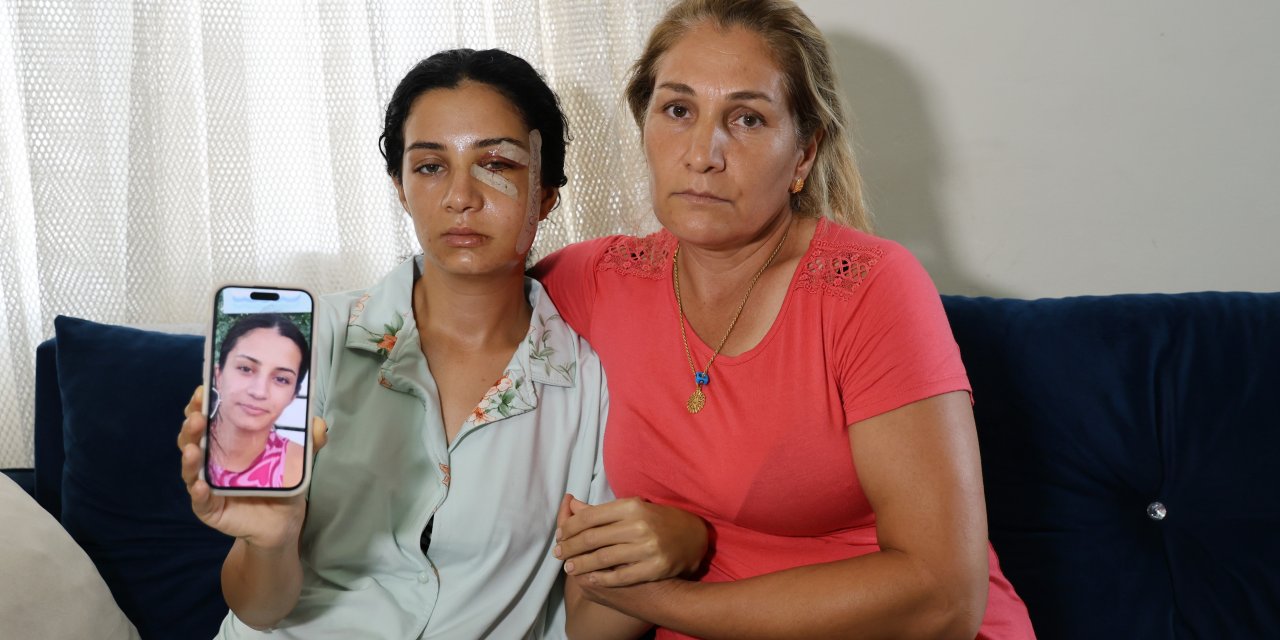 Şiddet mağduru kadın isyan etti: Eski eş tutuklandı