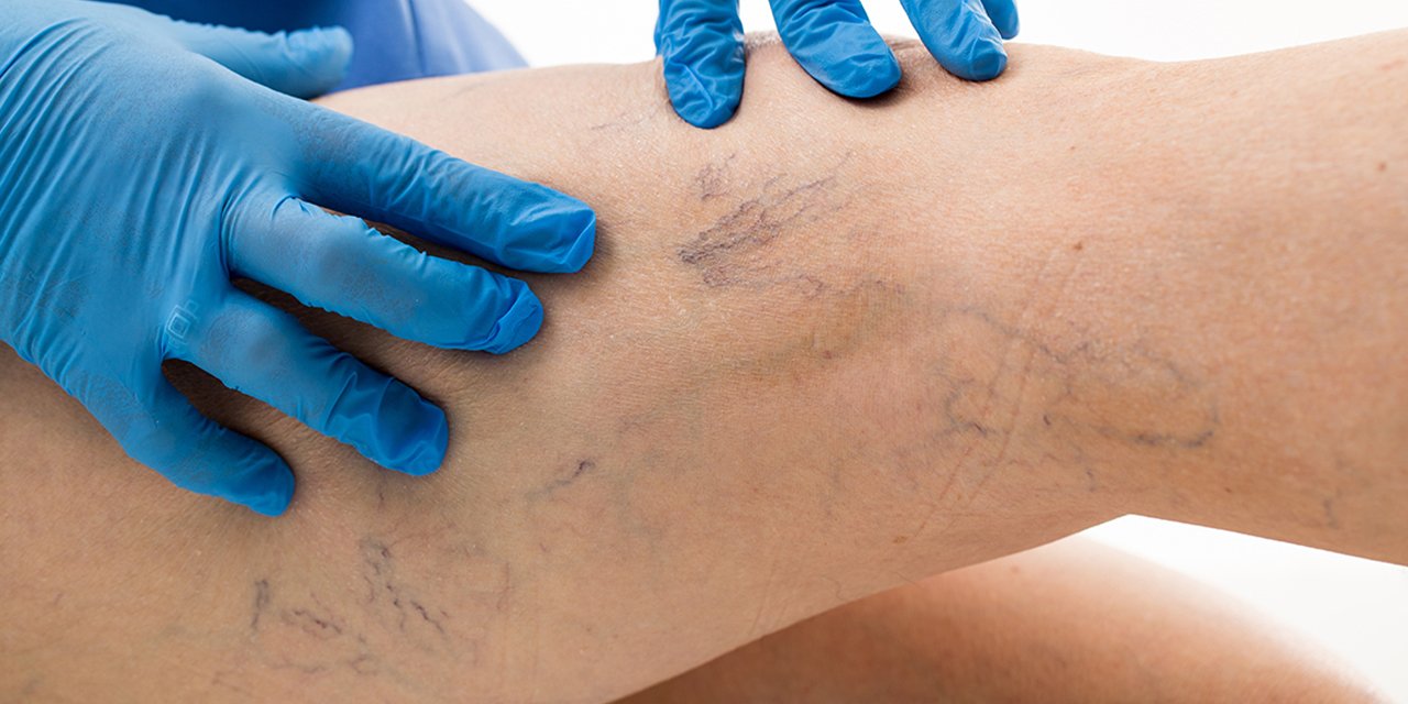 Konya'da uzmanı uyardı: Yatış pozisyonunuz riski arttırıyor