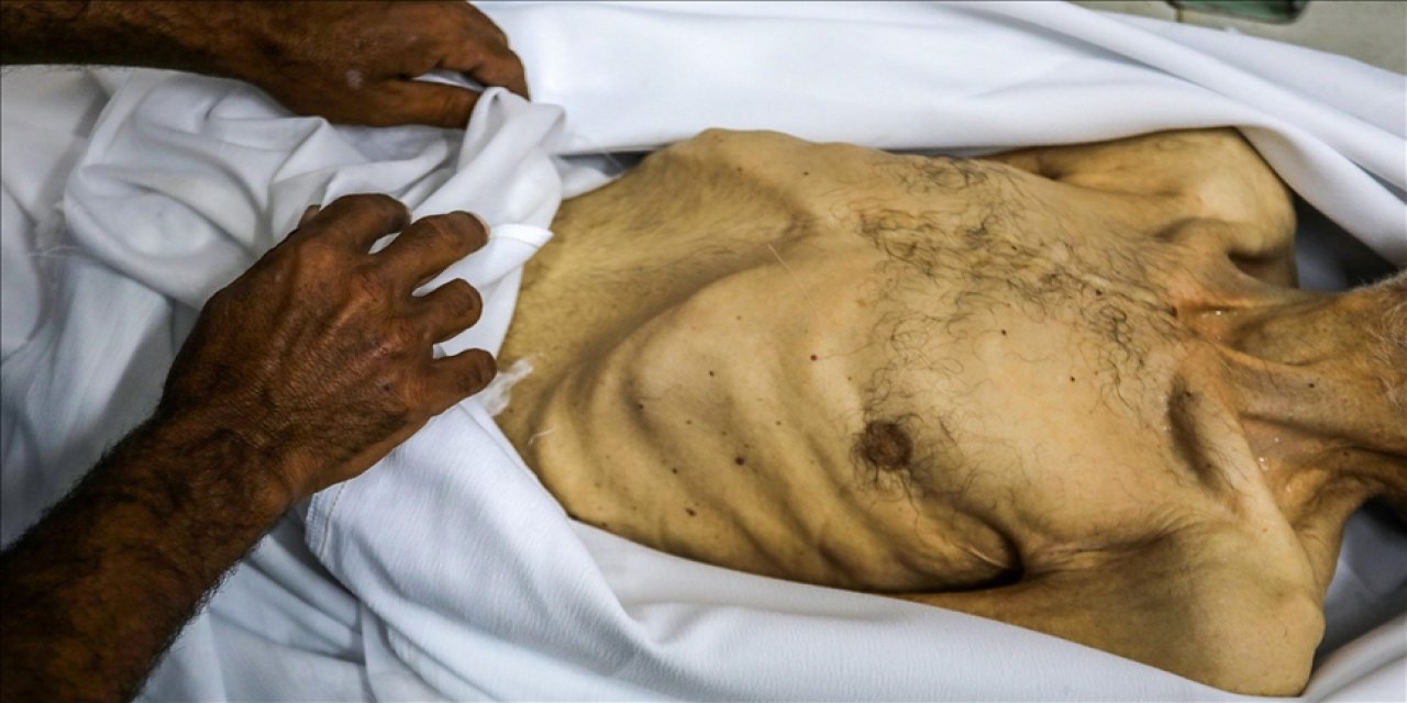 Gazze'de son 24 saatte 7 kişi daha açlıktan hayatını kaybetti