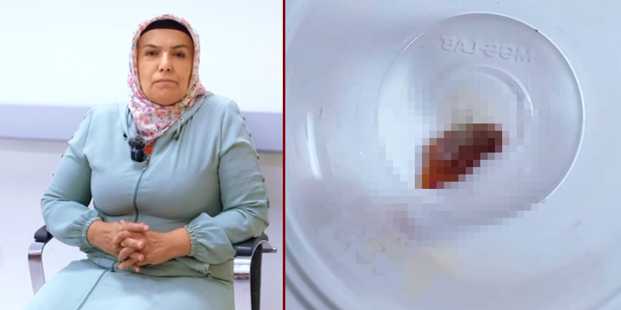 Öksürüğü 1.5 yıldır geçmiyordu! Sebebi şaşkına çevirdi