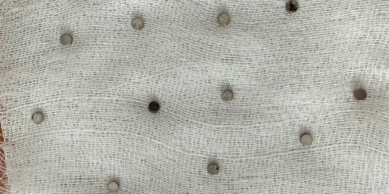 3 Yaşındaki çocuğun midesinden 19 mıknatıs çıktı