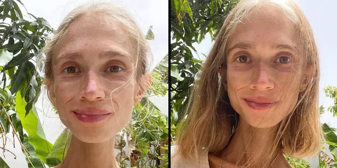 Yaptığı diyet sonu oldu! 22 kiloya düşen fenomen ölü bulundu