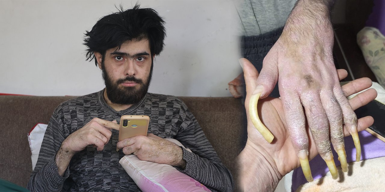 3 yıl duş almadı! Asıl gerçek ortaya çıktı