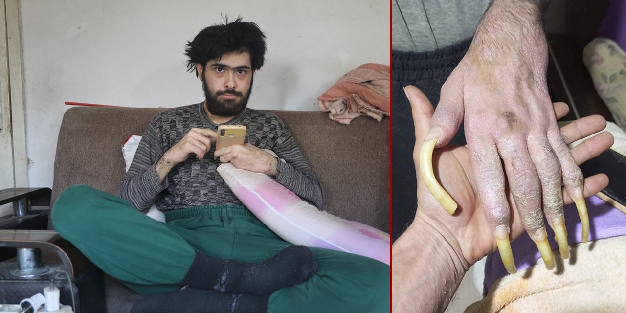 Türkiye'nin konuştuğu gencin eski hali ortaya çıktı