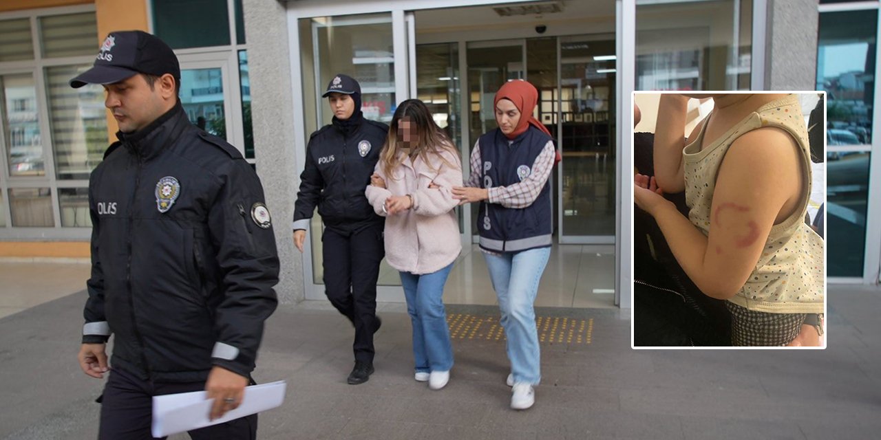 3 yaşındaki öğrencisinin kolunu ısıran öğretmen hakkında karar