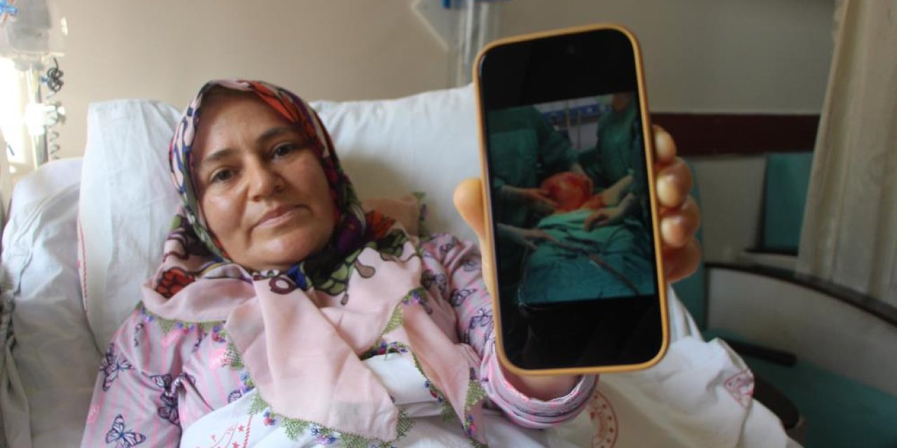 Karnı 2 ayda 9 aylık hamile gibi büyüdü, çıkan doktorları da şoke etti