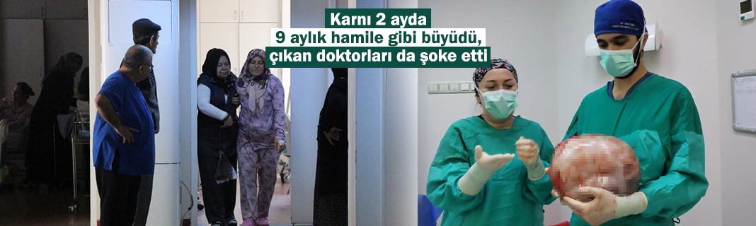 Karnı 2 ayda 9 aylık hamile gibi büyüdü, çıkan doktorları da şoke etti