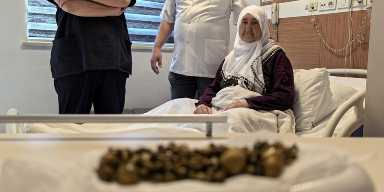 Karın ağrısıyla gittiği hastaneden 213 taşla döndü