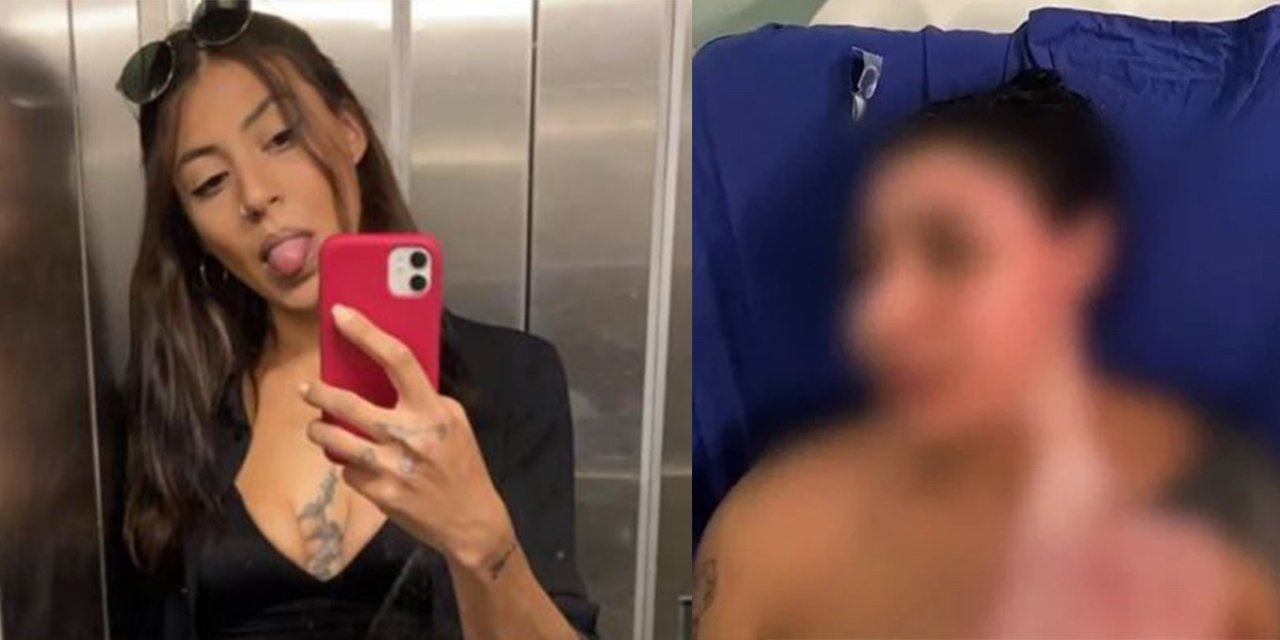 Kıskançlık krizi dehşeti! Kadına yanıcı madde döküp yaktı